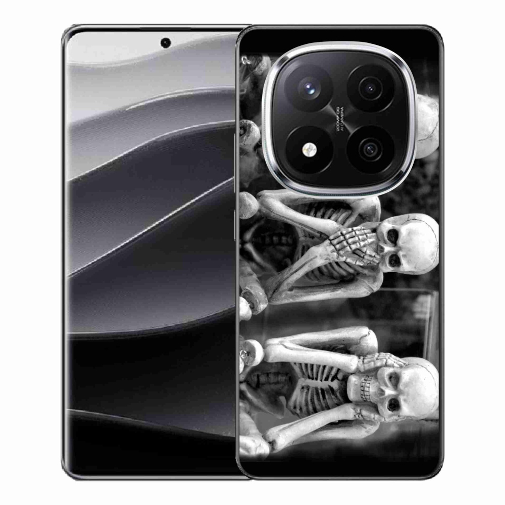 Gél borítás mmCase a Xiaomi Redmi Note 14 Pro+ 5G - csontvázakhoz