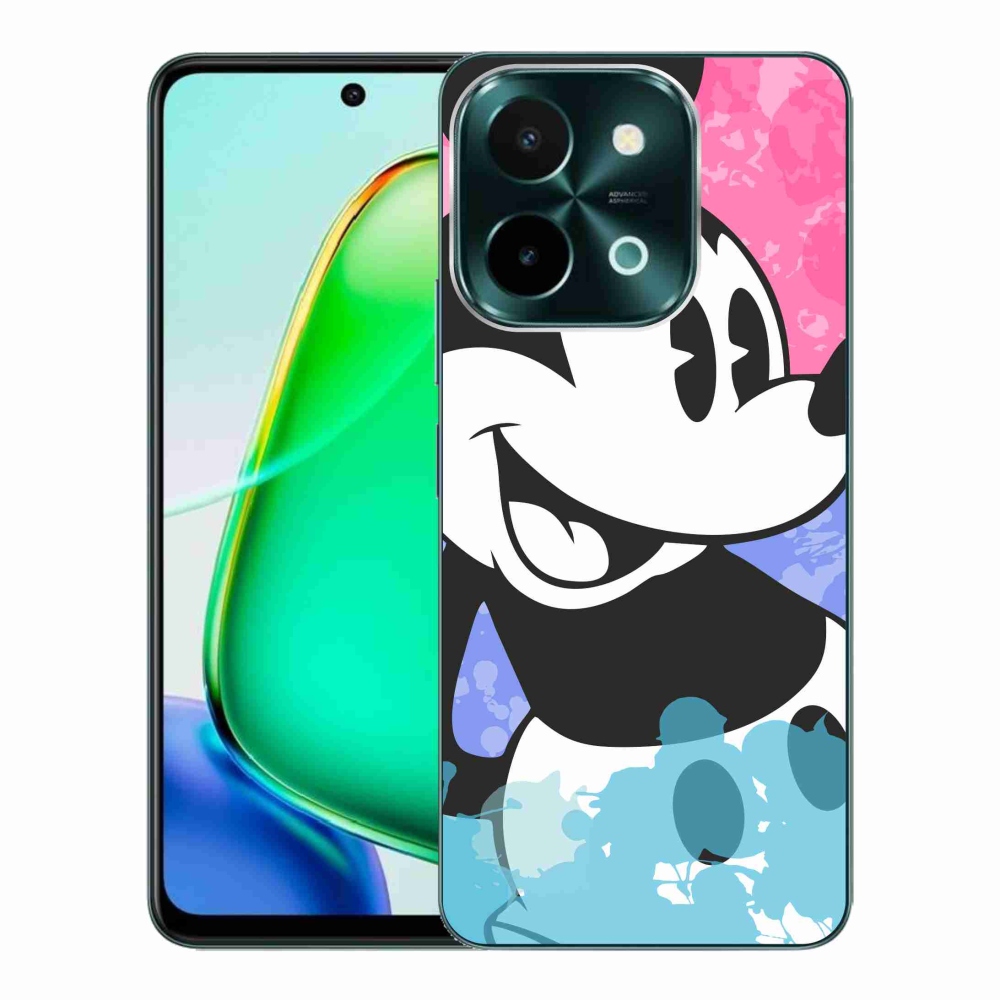 Zselés borítás mmCase Vivo Y28-hoz - mickey egér
