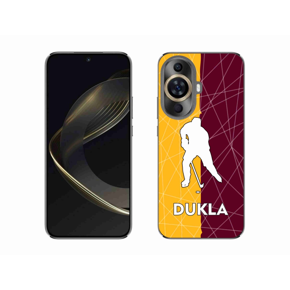 Gél borítás mmCase a Huawei Nova 11 készülékre - Dukla