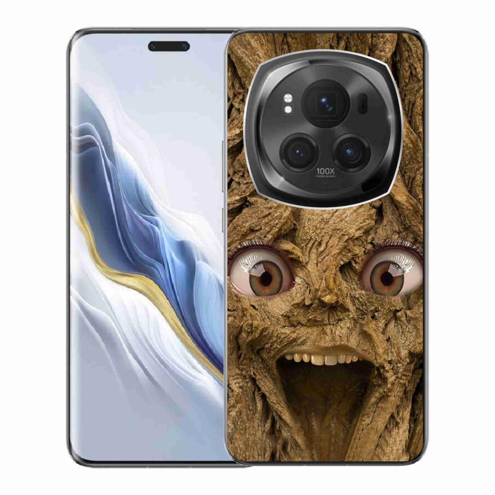 Gél borítás mmCase a Honor Magic 6 Pro 5G számára - boldog fa szemekkel