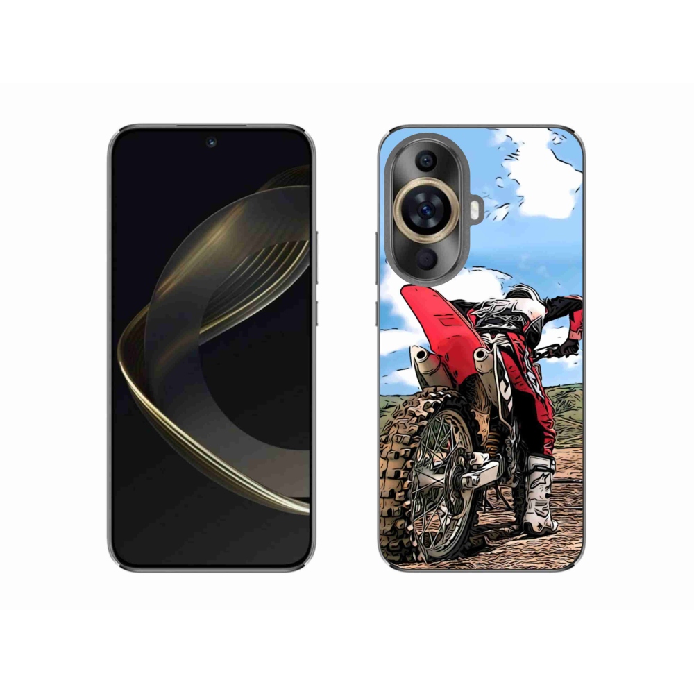 Gél borítás mmCase a Huawei Nova 11 készülékhez - moto