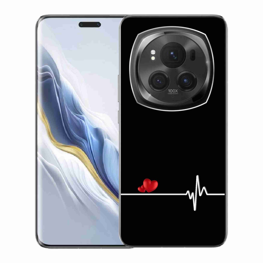 Gél borító mmCase a Honor Magic 6 Pro 5G készülékhez - szív és szívverés fekete háttérrel