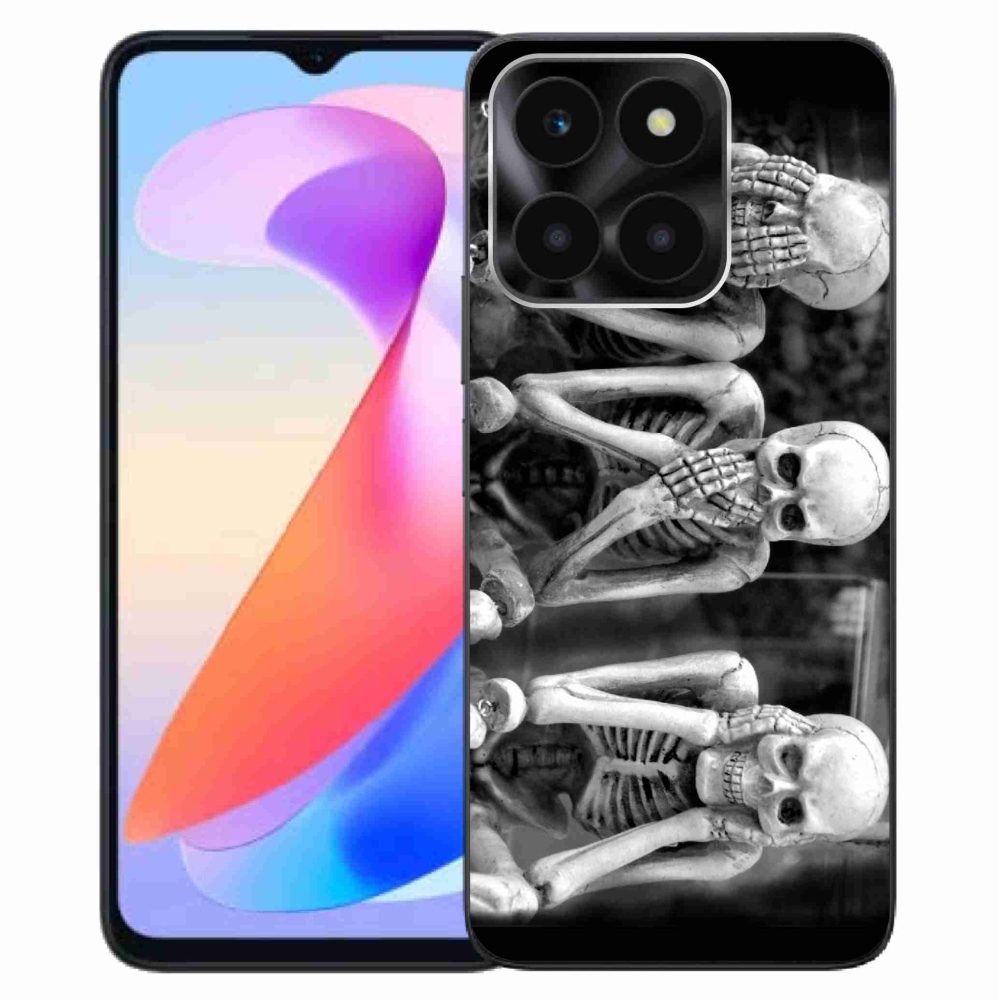 Zselés borítás mmCase a Honor X6a számára - csontvázak
