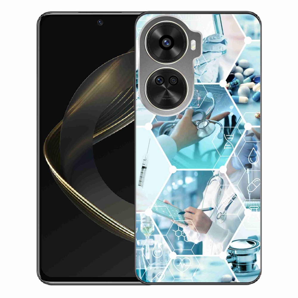 Gél borítás mmCase a Huawei Nova 12 SE-hez - egészség