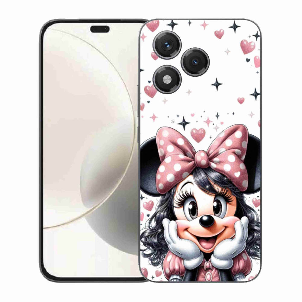 Zselés borítás mmCase a Honor 400 Lite-hoz - minnie