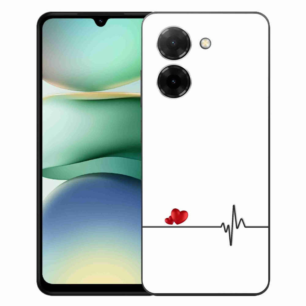 Gél borító mmCase a Xiaomi Redmi A5 (171.7x77.8x8.3mm) - szív és szívverés fehér háttérrel