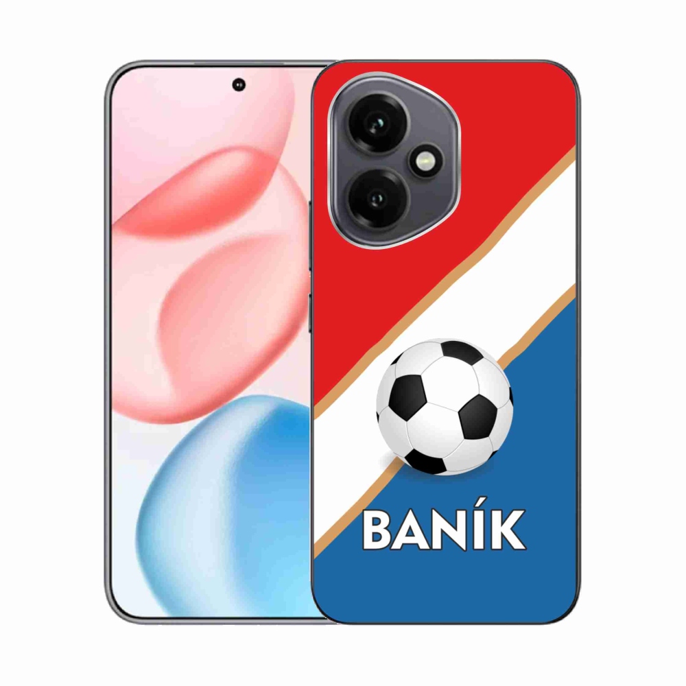 Zselés borítás mmCase a Honor 400-hoz - Baník