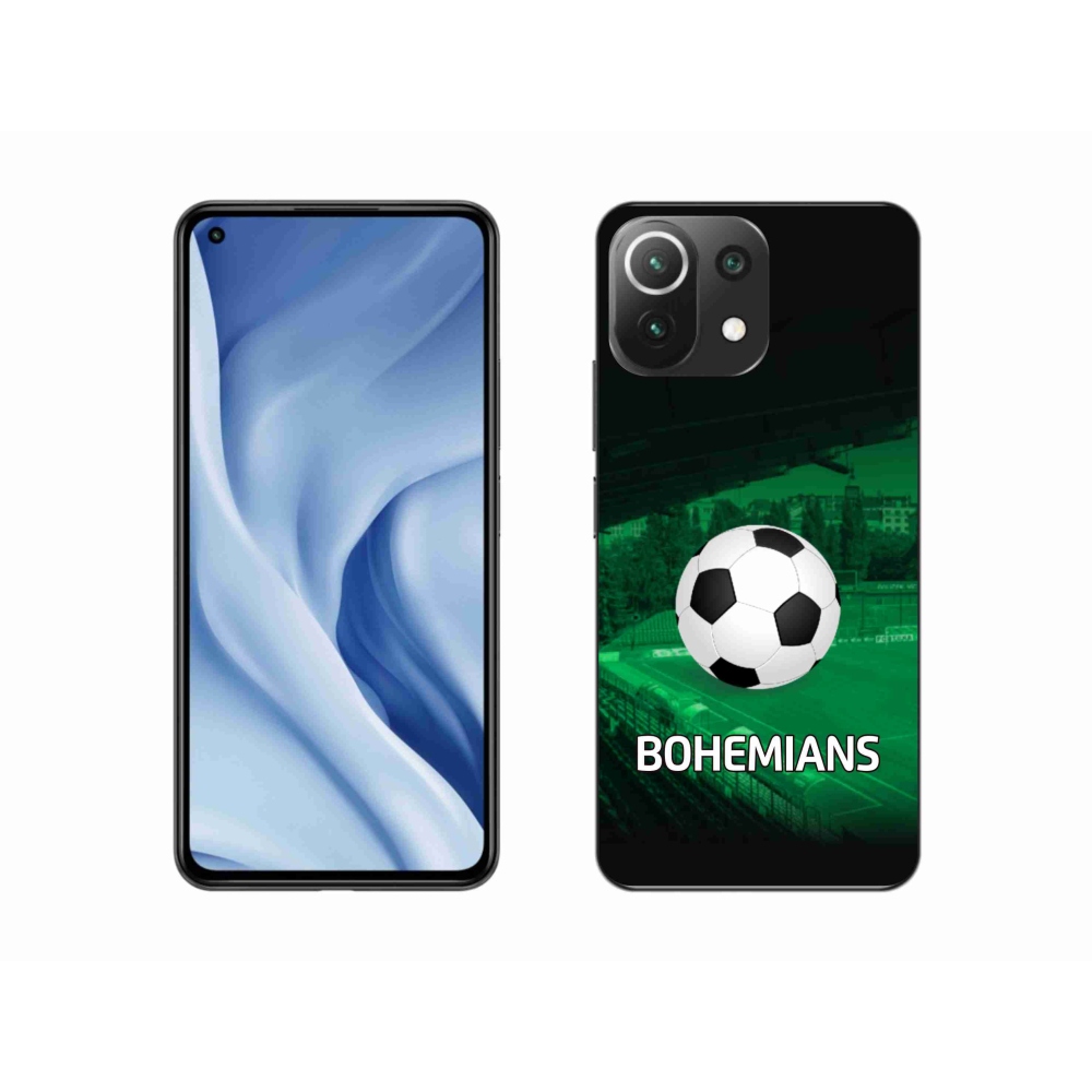 Gél borítás mmCase a Xiaomi Mi 11 Lite 4G/5G-hez - bohemians 1