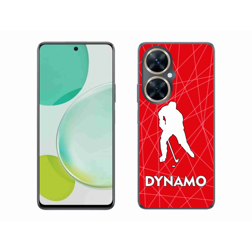 Gél borítás mmCase a Huawei Nova 11i készülékhez - Dynamo 2