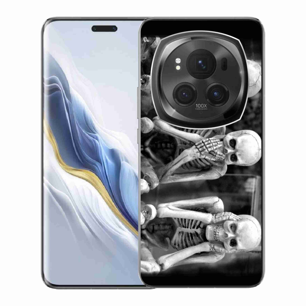 Zselés borítás mmCase a Honor Magic 6 Pro 5G számára - csontvázak