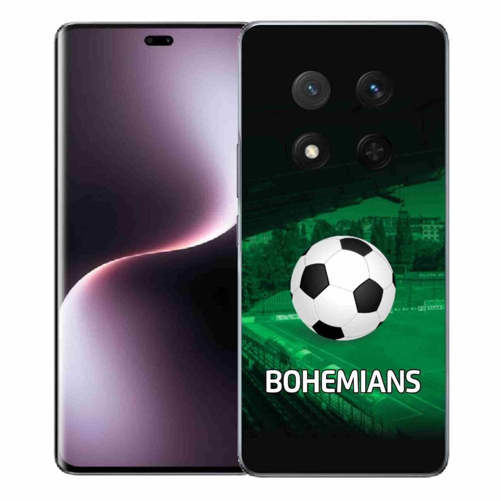 Gél borítás mmCase a Honor Magic 7 Lite 5G készülékhez - bohémek 1