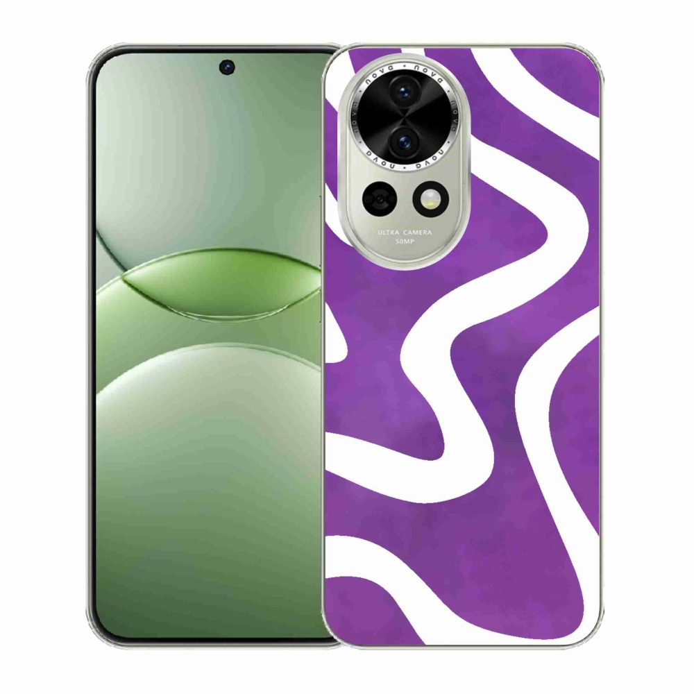 Gél borítás mmCase a Huawei Nova 13 5G-n - kivonat 30