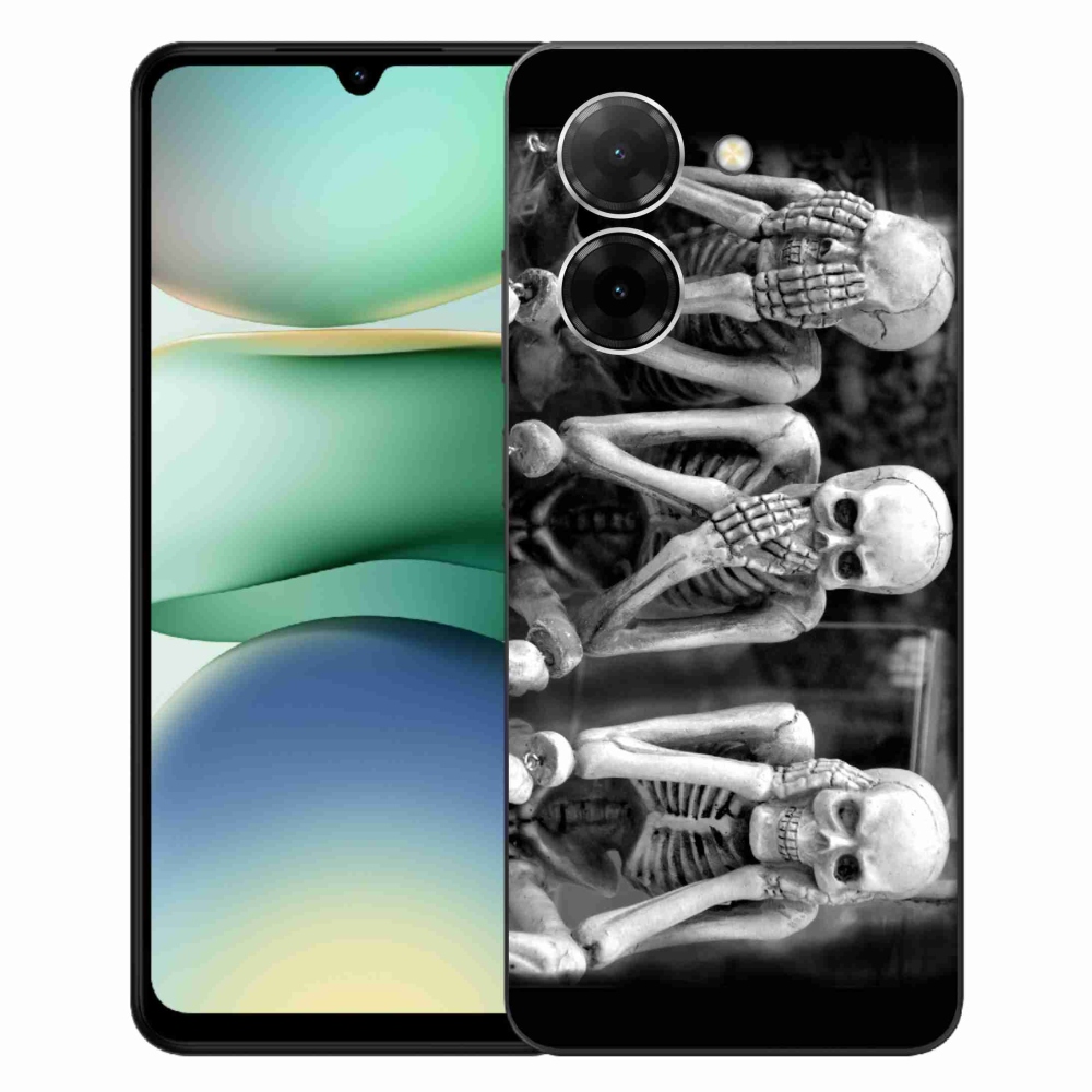 Gél borítás mmCase a Xiaomi Redmi A5 (173.45x79.35x8.45mm) - csontvázakhoz