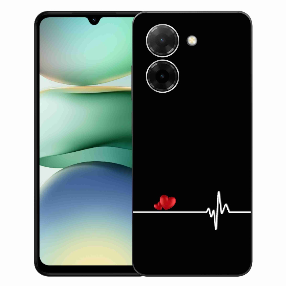 Gél borító mmCase a Xiaomi Redmi A5 (173.45x79.35x8.45mm) - szív és szívverés fekete háttérrel