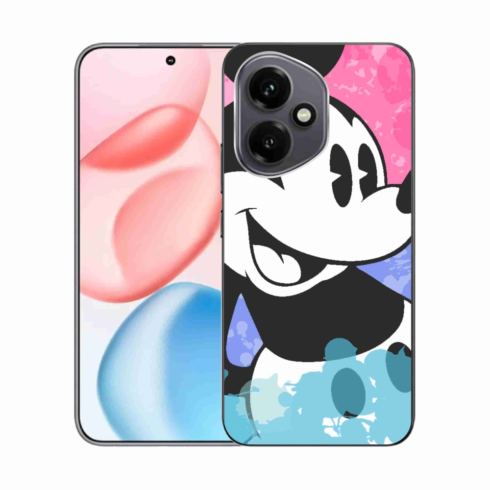 Zselés borítás mmCase a Honor 400-hoz - mickey egér