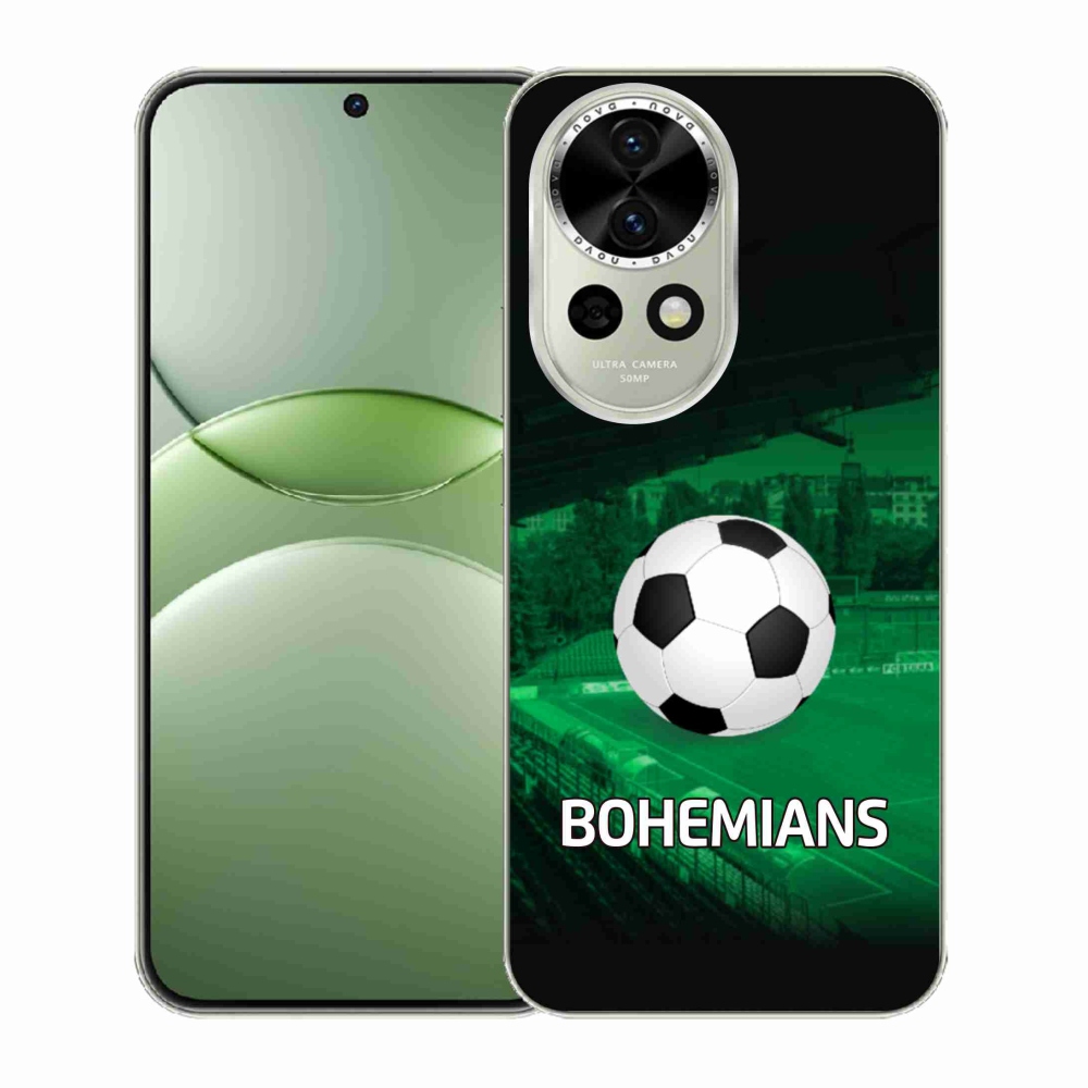 Gél borító mmCase a Huawei Nova 13 5G-n - bohémek 1