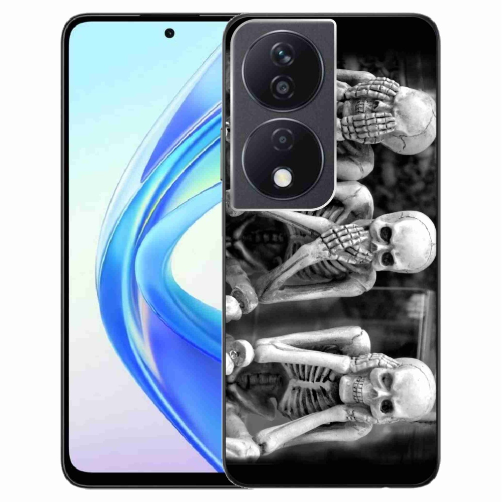 Gél védőburkolat mmCase a Honor X7b/Honor 90 Smart - csontvázakhoz