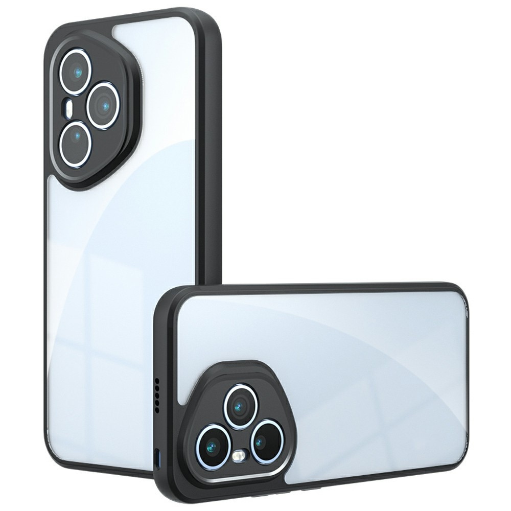 Gélkeretes tok fix hátlappal Honor 400 Pro-hoz - fekete