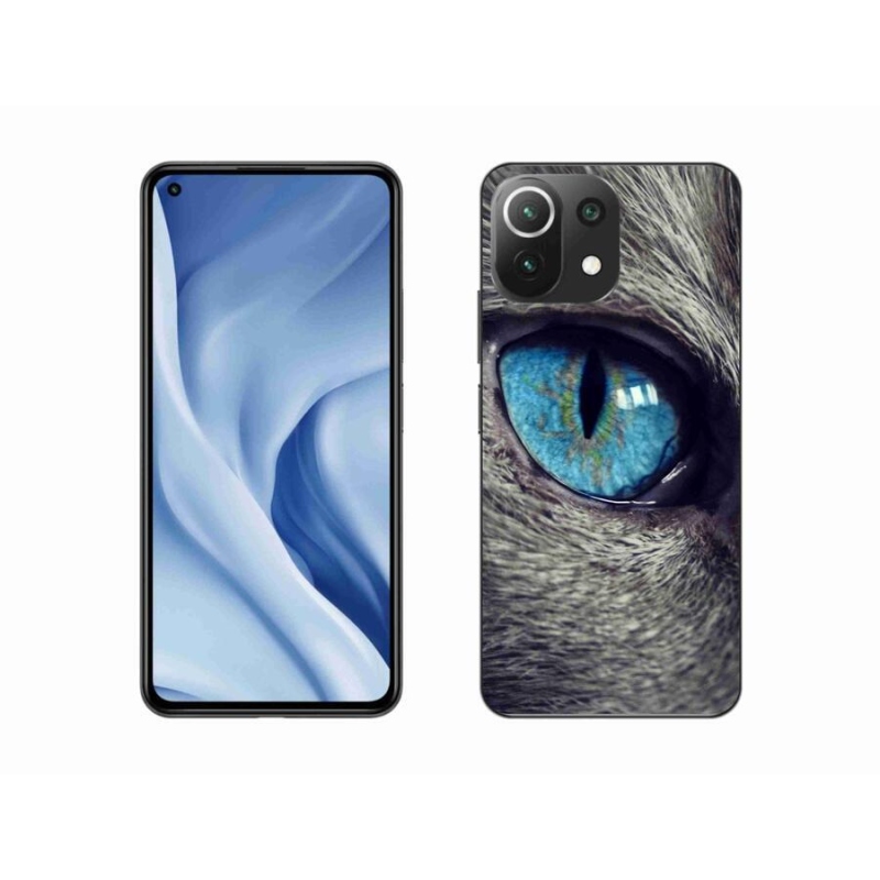 Gél tok mmCase a Xiaomi Mi 11 Lite 4G/5G készülékhez - kék macskaszem
