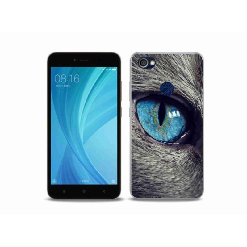Gél tok mmCase a Xiaomi Redmi Note 5A Prime készülékhez - kék macskaszem