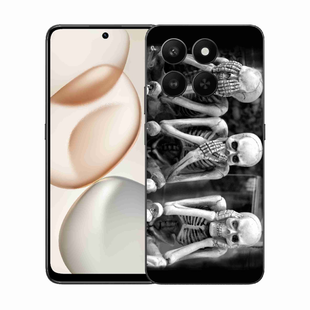 Zselés borítás mmCase a Honor 400 Smart 5G/4G/Honor X7d számára - csontvázak