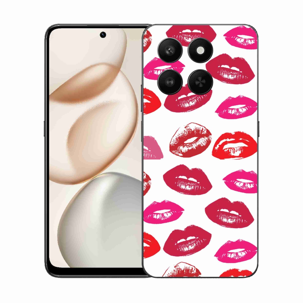 Gél védőburkolat mmCase a Honor 400 Smart 5G/4G/Honor X7d készülékhez - ajkak