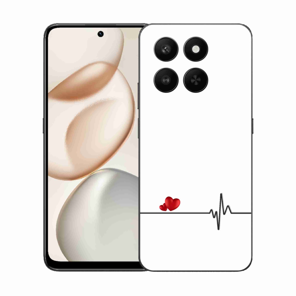 Gél borító mmCase a Honor 400 Smart 5G/4G/Honor X7d készülékhez - szív és szívverés fehér háttérrel