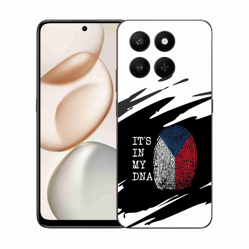 Gél borítás mmCase a Honor 400 Smart 5G/4G/Honor X7d számára - Zászlós ujjlenyomat fekete és fehér háttérrel