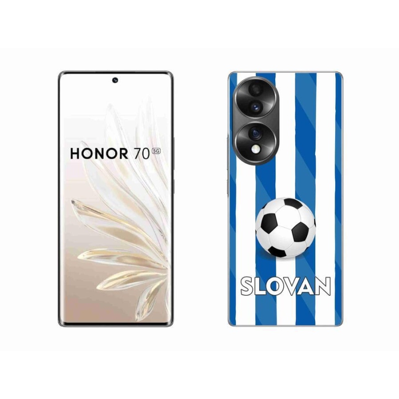 Zselés borítás mmCase a Honor 70 készülékhez - Slovan