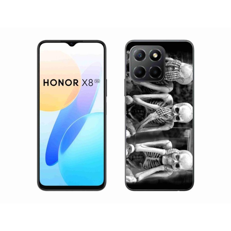 Zselés borítás mmCase a Honor X8 5G/Honor 70 Lite 5G számára - csontvázak