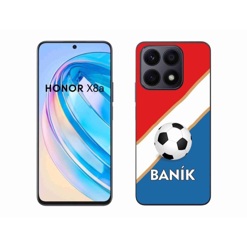 Zselés borítás mmCase a Honor X8a készülékhez - Baník