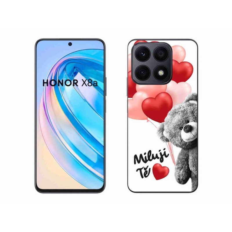Gél borítás mmCase a Honor X8a számára - Szeretlek