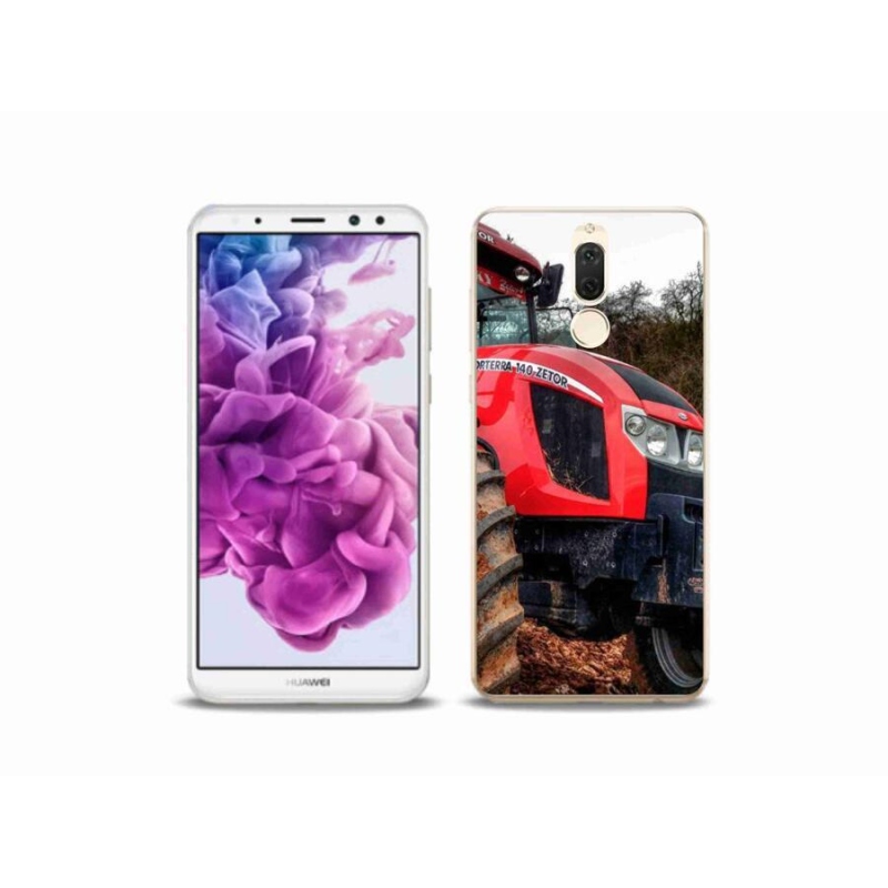 Gél borítás mmCase a Huawei Mate 10 Lite készülékhez - zetor