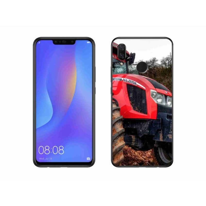 Gél borítás mmCase a Huawei Nova 3i készülékhez - zetor