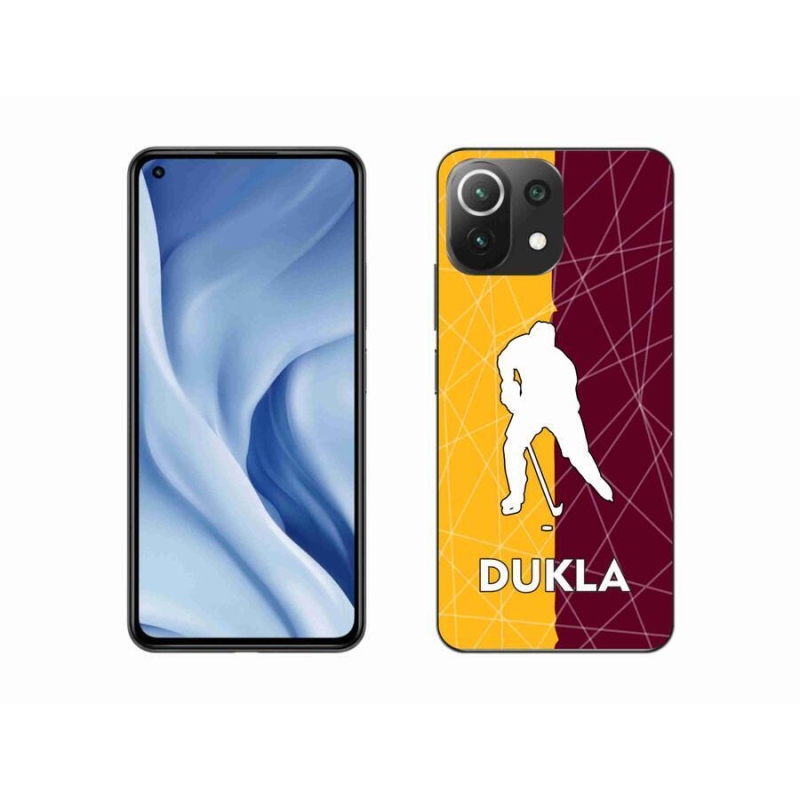 Gél borítás mmCase a Xiaomi 11 Lite 5G NE számára - Dukla