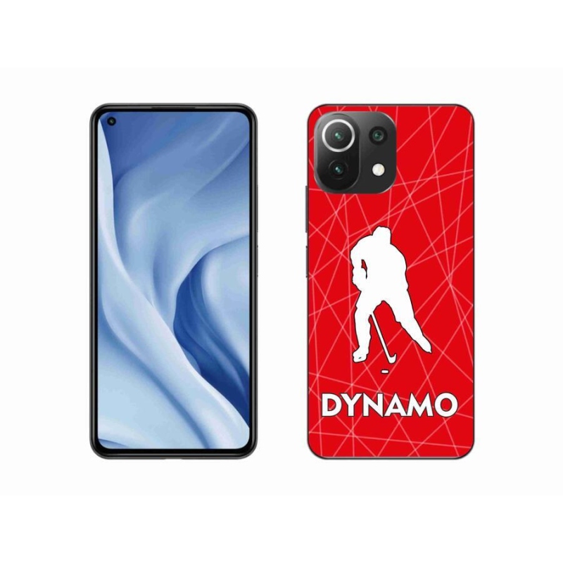 Gél borítás mmCase a Xiaomi 11 Lite 5G NE - Dynamo 2 számára