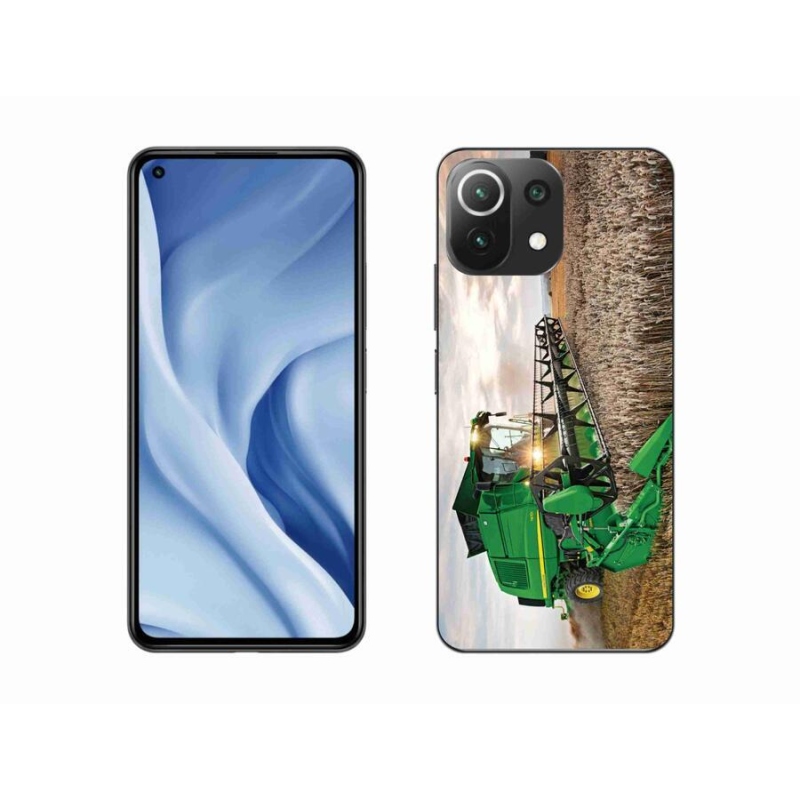 Gél borítás mmCase a Xiaomi 11 Lite 5G NE-hez - kombinálni