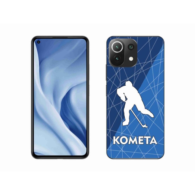 Gél borítás mmCase a Xiaomi 11 Lite 5G NE számára - Comet