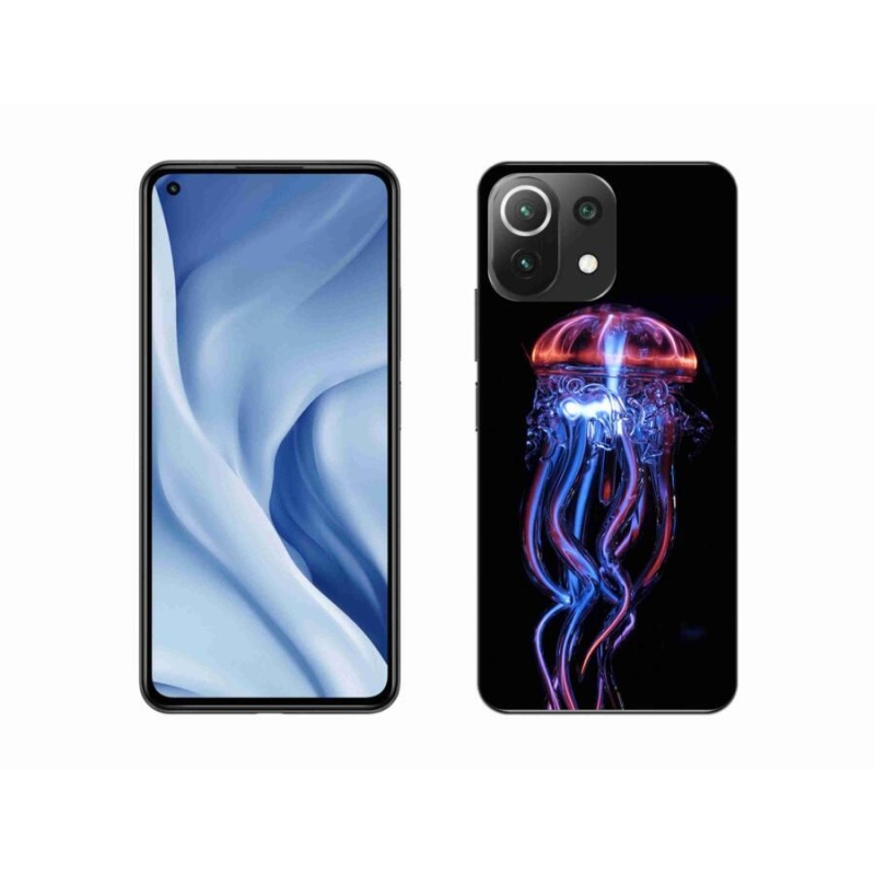 Gél borítás mmCase a Xiaomi 11 Lite 5G NE számára - medúza