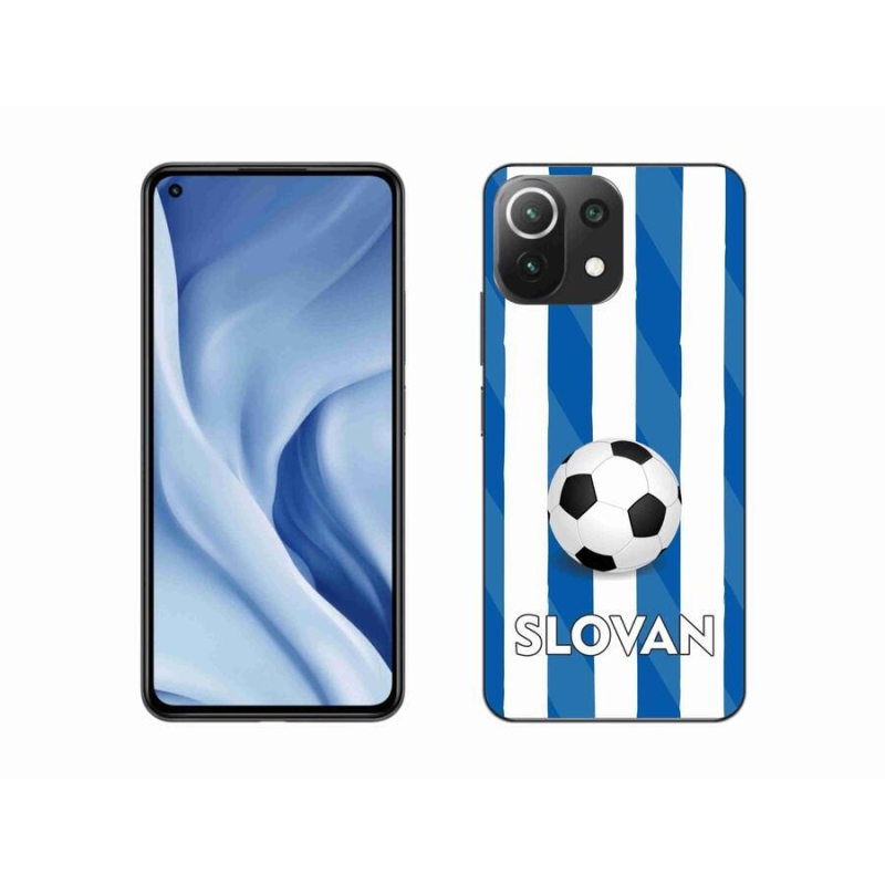 Gél borítás mmCase a Xiaomi 11 Lite 5G NE számára - Slovan