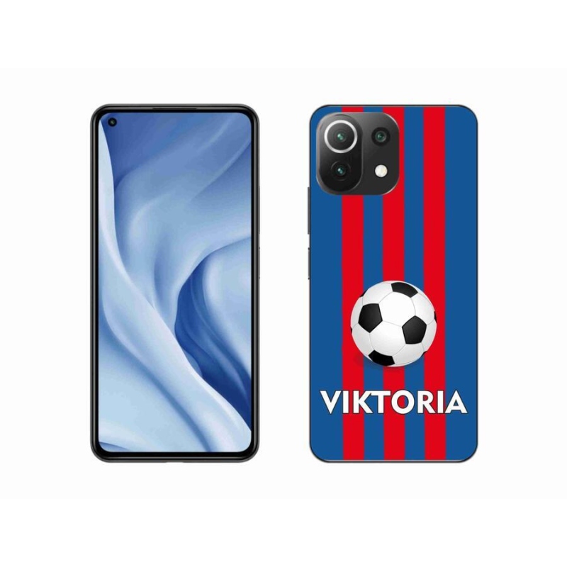 Gél borítás mmCase a Xiaomi 11 Lite 5G NE számára - Victoria