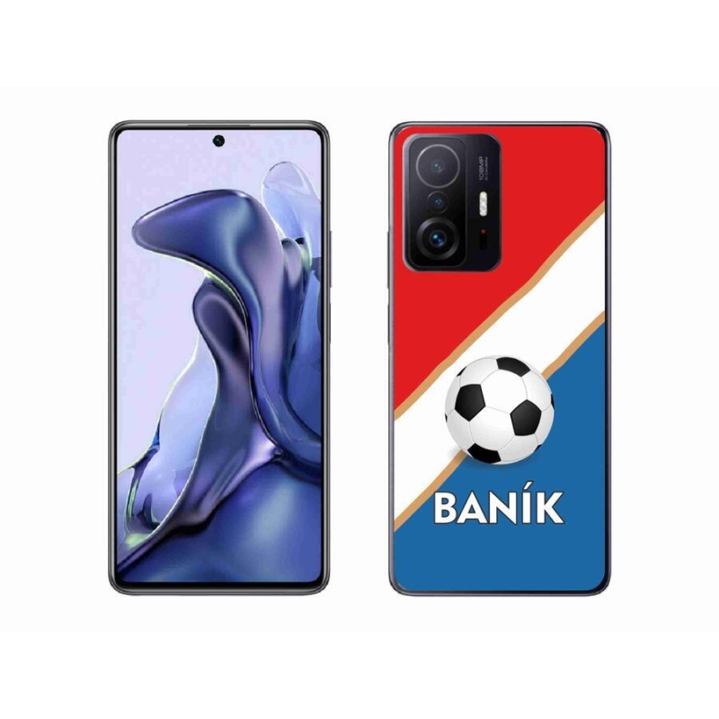 Gél borítás mmCase a Xiaomi 11T-hez - Baník