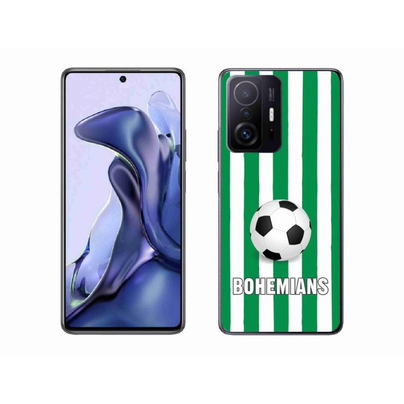 Gél borítás mmCase a Xiaomi 11T-hez - Bohemians