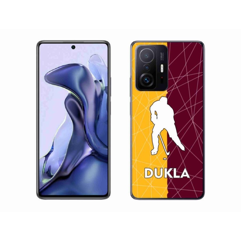 Gél borítás mmCase a Xiaomi 11T-hez - Dukla