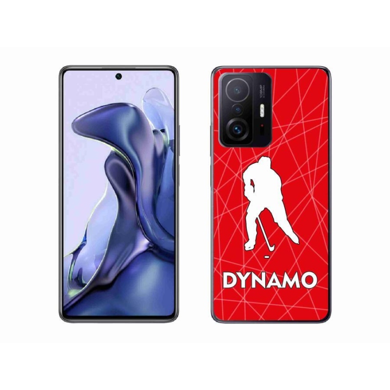 Zselés borítás mmCase a Xiaomi 11T-hez - Dynamo 2