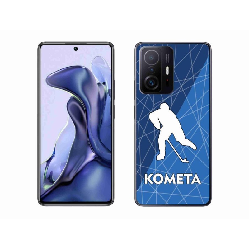 Gél borítás mmCase a Xiaomi 11T-hez - Comet