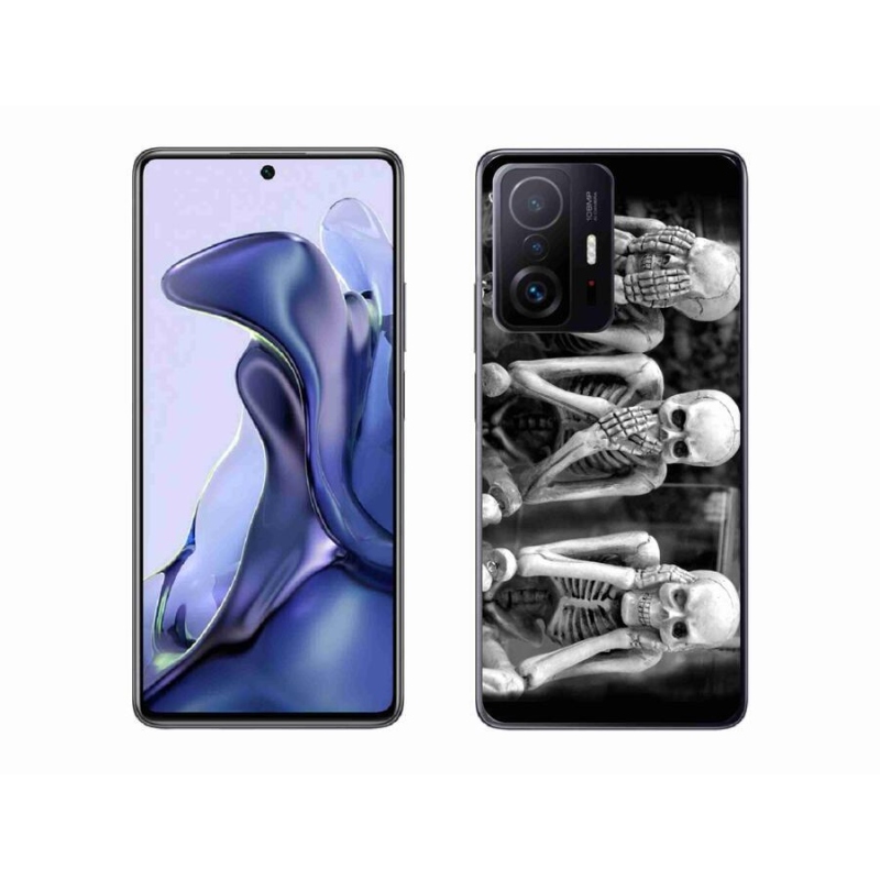Gél borítás mmCase a Xiaomi 11T számára - csontvázak