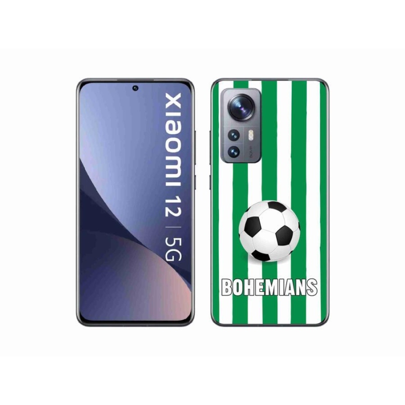 Gél borítás mmCase a Xiaomi 12-hez - Bohemians