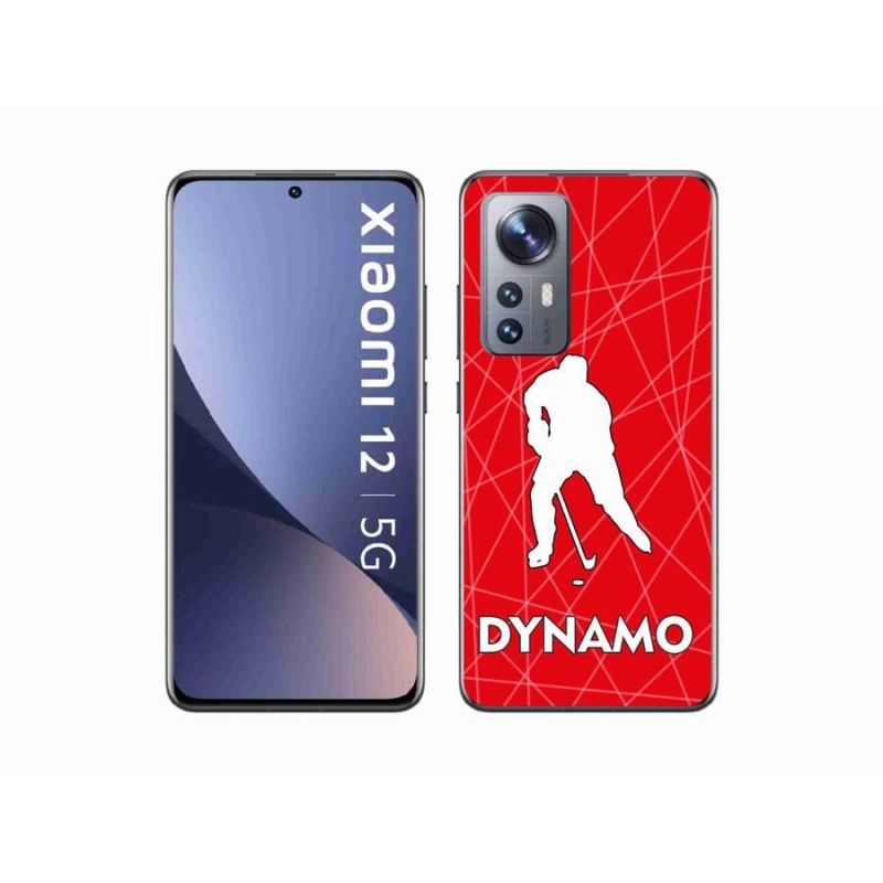 Gél borítás mmCase a Xiaomi 12 - Dynamo 2 készülékhez