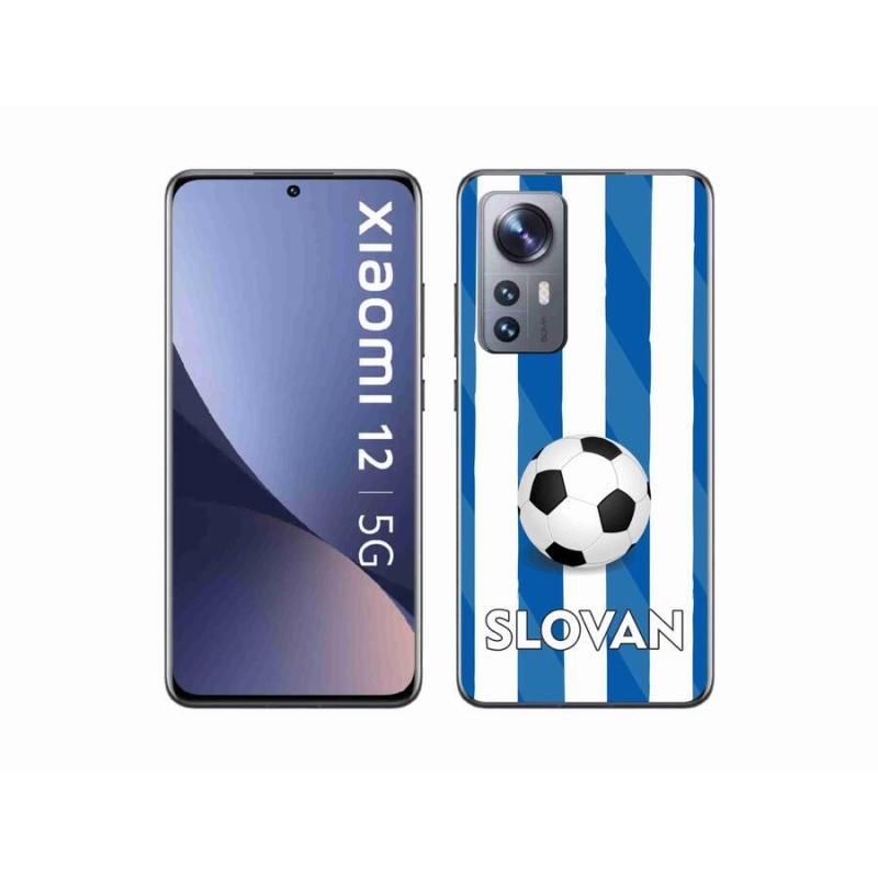 Gél borítás mmCase a Xiaomi 12-hez - Slovan